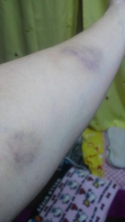 �ɂ����ǁB